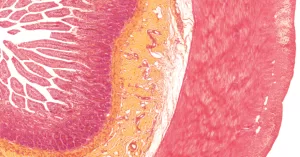 514-zoom-1.png