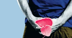 biopsia-de-prostata.png