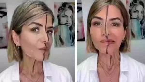 bita-farrell-instagram-botox-lado-efeitos.jpg