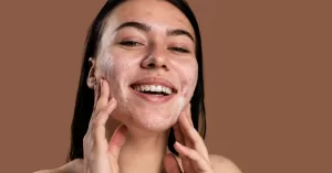 purging-acne-skincare-reacao.jpg