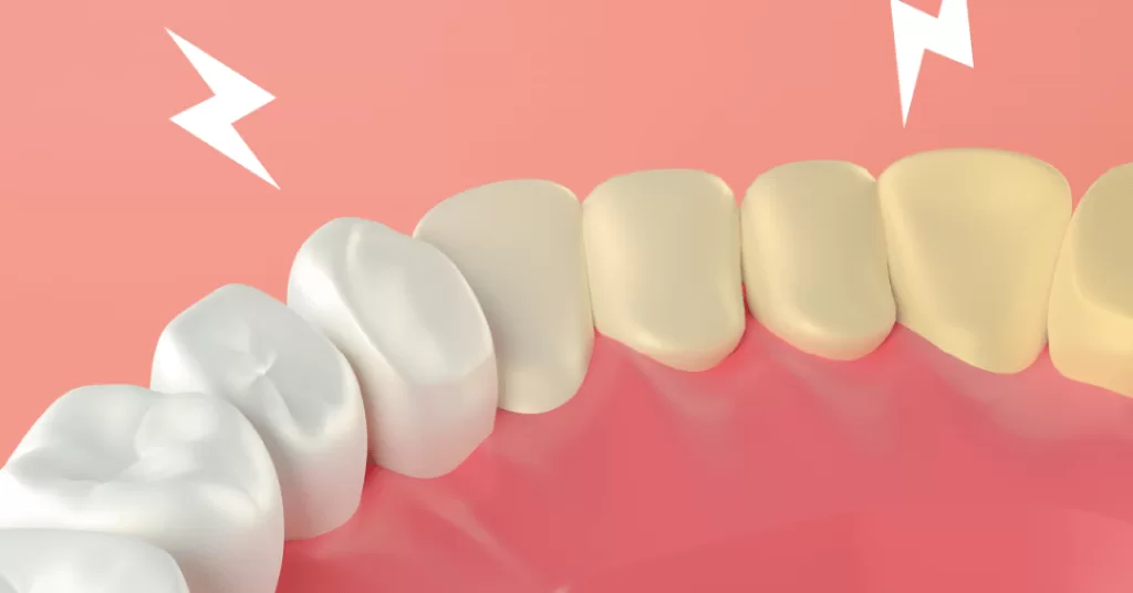 514-autoestima-dentes-brancos.png