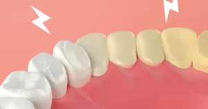 514-autoestima-dentes-brancos.png