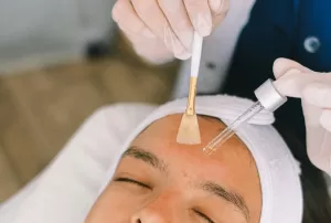 peeling.png
